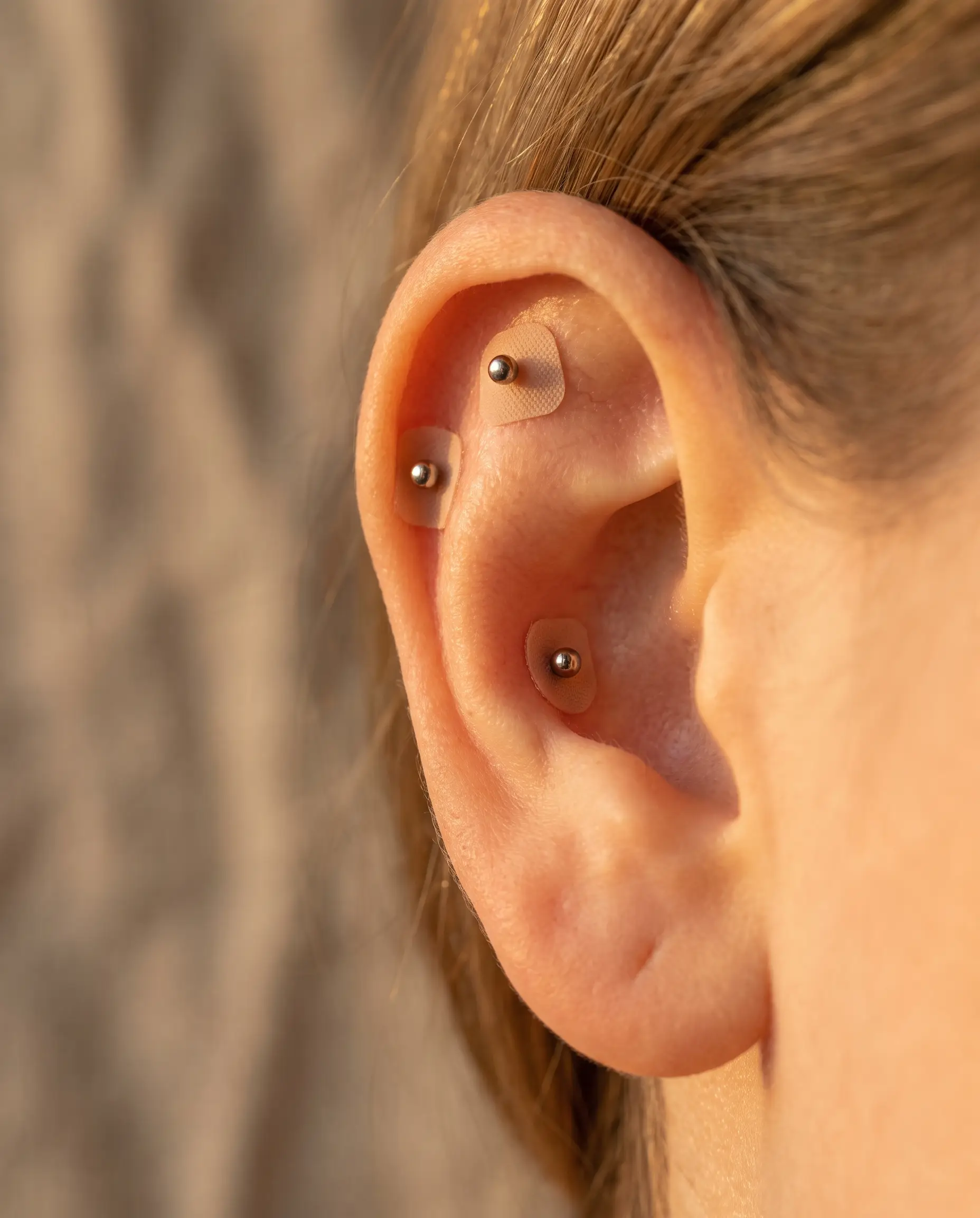 Small ear seeds placed on the outer ear